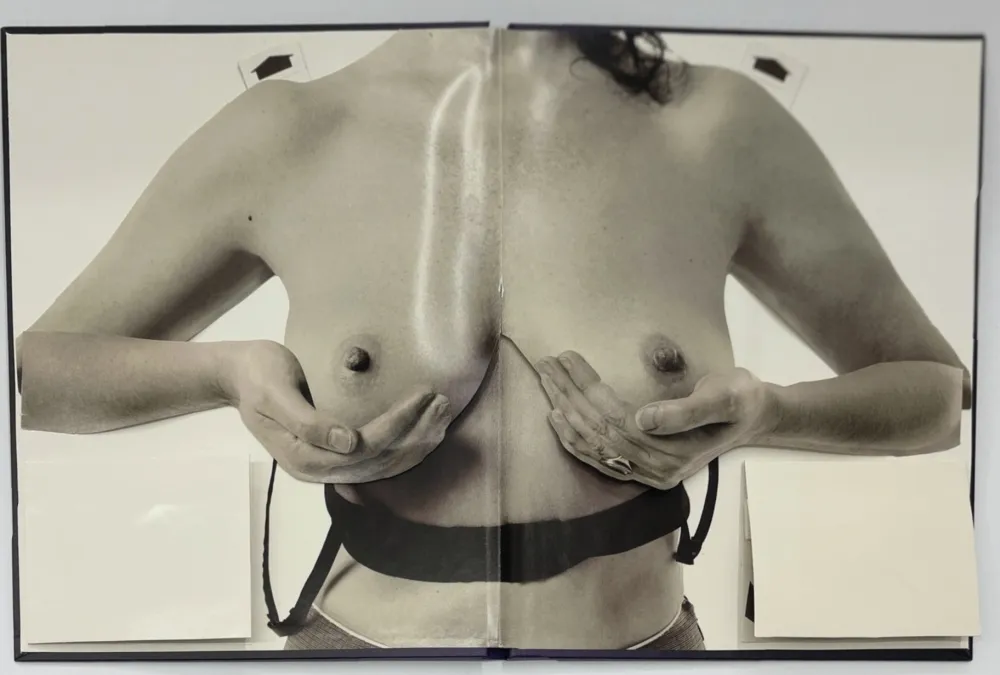 Photography Calle - Les seins miraculeux (Beautiful breasts)