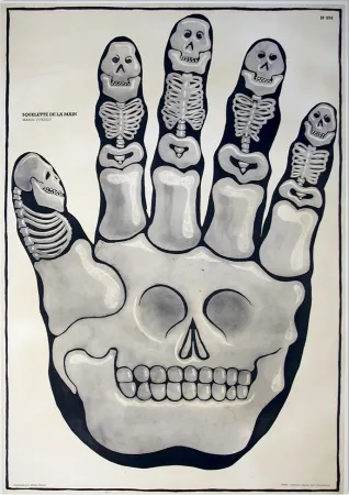 Etching Di Rosa - La main