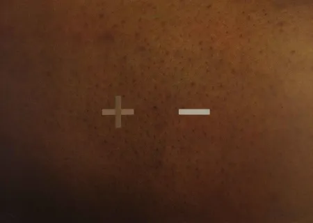 Screenprint Dias - S.T.