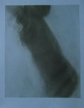 Engraving Garache - Bleue