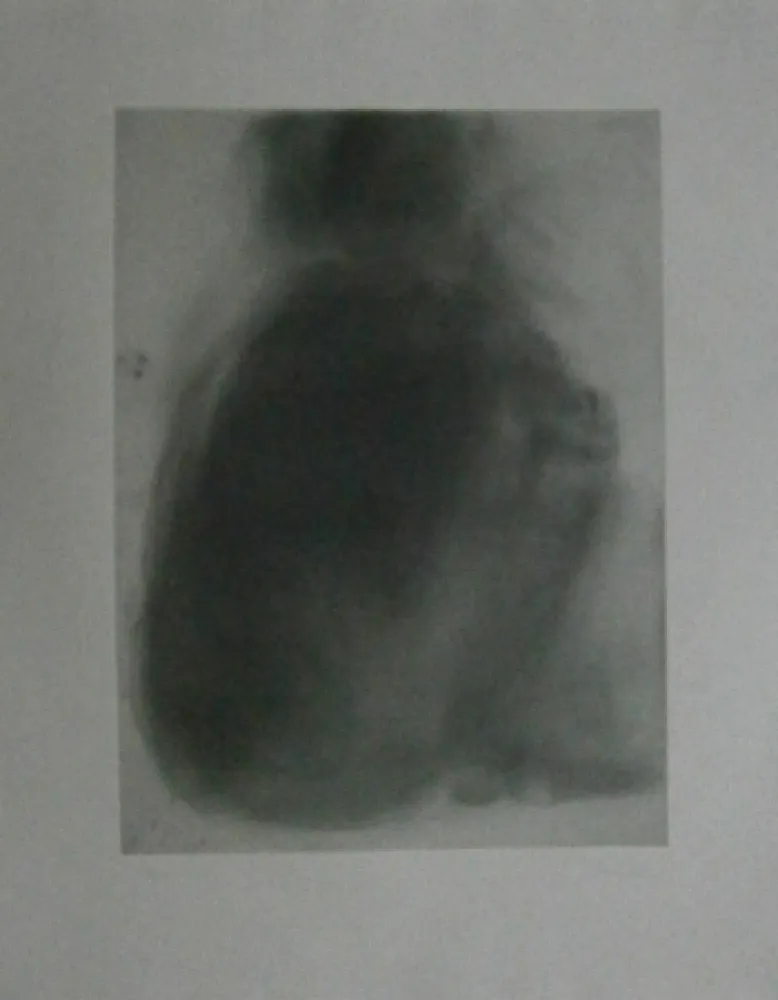 Engraving Garache - Tourette