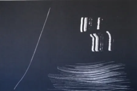 Lithograph Hartung - Farandole 9