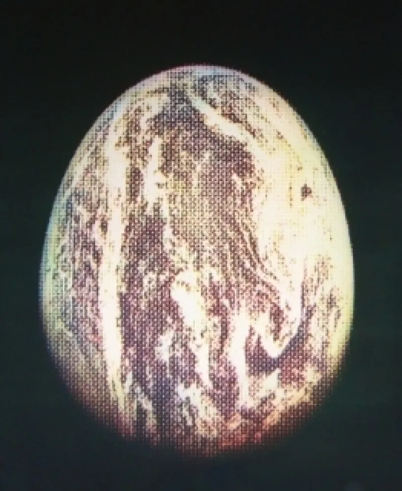 Etching And Aquatint Jacquet - L'oeuf