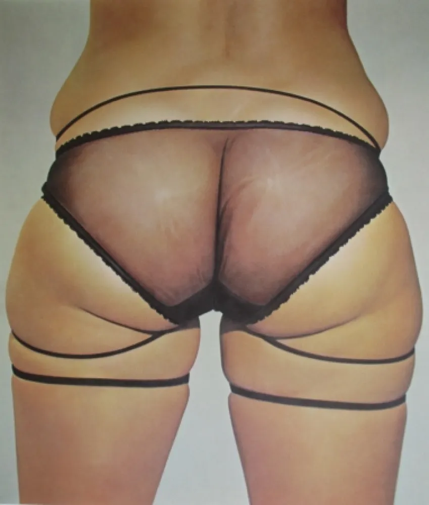 Lithograph Kacere - Loretta 