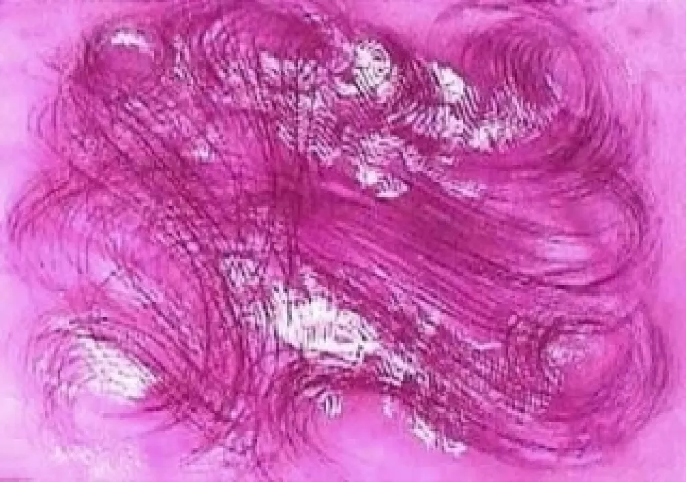 Etching And Aquatint Messagier - Les mangeurs de vent 